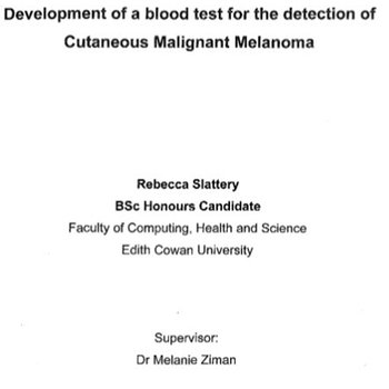Development of a blood test for the detection of cutaneous malignant melanoma