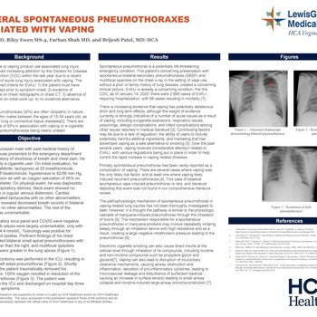 Bilateral Spontaneous Pneumothoraxes Associated with Vaping