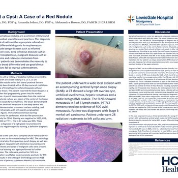 Not Just a Cyst: A Case of a Red Nodule