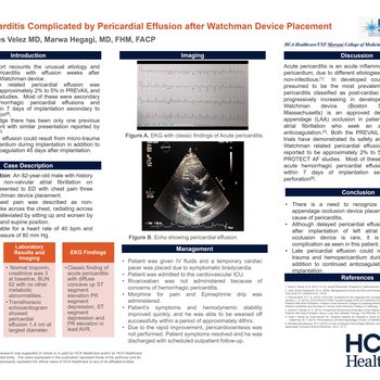 Late Pericarditis Complicated by Pericardial Effusion After Watchmen Device Placement