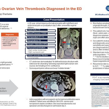 A Case of Postpartum Ovarian Vein Thrombosis Diagnosed in the ED