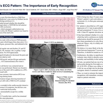 De Winter’s ECG: The Importance of Early Recognition