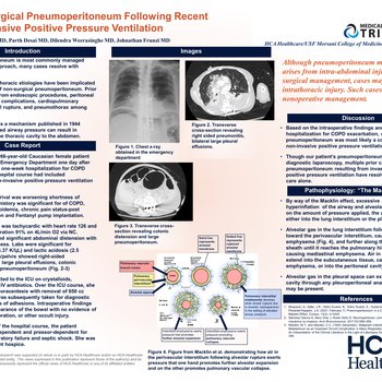 Development of Non-surgical Pneumoperitoneum Following Recent Positive Pressure Ventilation for COPD Exacerbation