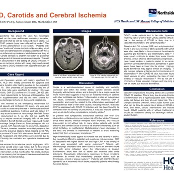 COVID, Carotids and Cerebral Ischemia