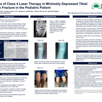 The Use of Class 4 Laser Therapy in Minimally Depressed Tibial Plateau Fracture in the Pediatric Patient