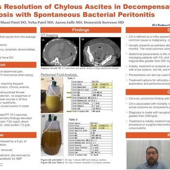 Spontaneous Resolution of Chylous Ascites in Decompensated Cirrhosis with Spontaneous Bacterial Peritonitis