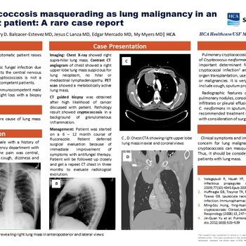 Pulmonary Cryptococcosis Masquerading as Lung Malignancy in an Immunocompetent Patient: A Rare Case Report