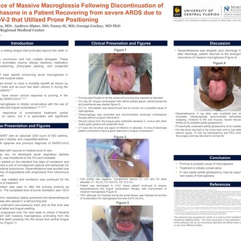 Recurrence of Massive Macroglossia Following Discontinuation of Dexamethasone in a Patient Recovering from severe ARDS due to SARS-CoV-2 that Utilized Prone Positioning