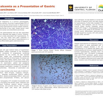 Hypercalcemia as a Presentation of Gastric Adenocarcinoma