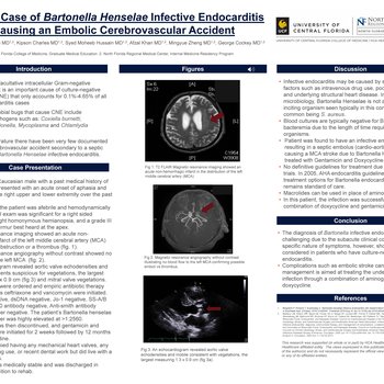 A Rare Case of Bartonella henselae Infective Endocarditis Causing an Embolic Cerebrovascular Accident