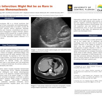 Splenic Infarction: Might Not be as Rare in Infectious Mononucleosis
