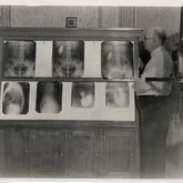 X-ray Viewing Box at Memorial Hospital, 1937