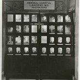 Memorial Hospital X-Ray Viewing Box (1930s)