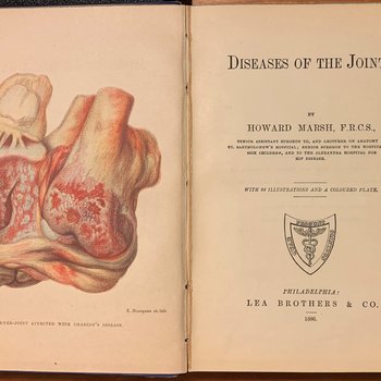 Diseases of the Joints