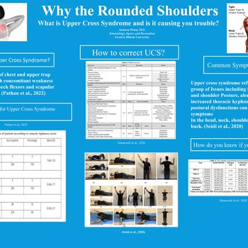 Why the Rounded Shoulders: What is Upper Cross Syndrome and is it causing you trouble?