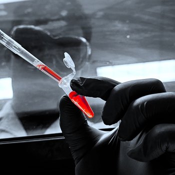 Handling the Heat: Extracting RNA for Heat-Shock Gene Analysis