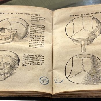 Anatomiae… corporis humani dissectionis pars prior (ca. 1608)
