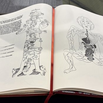 Fasciculus medicinae  (1738 edition, First printed 1495)