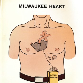 Milwaukee Heart diagram in chest with battery pack, 1990s