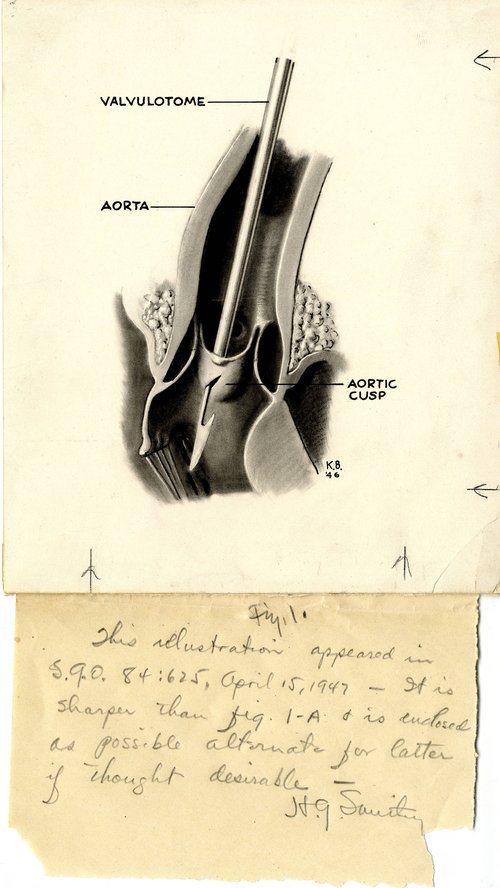 Black and white illustration of valvulotome instrument within the aorta. Notation written by Smithy appears on sheet attached to the illustration. Captions identify the aorta, valvulotome, and the aortic cusp.