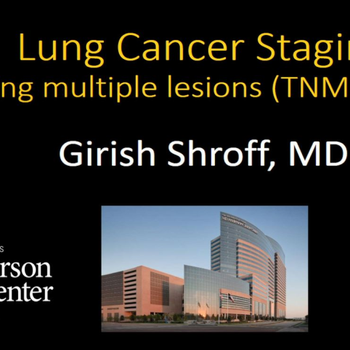 Lung Cancer Staging: T-staging multiple lesions