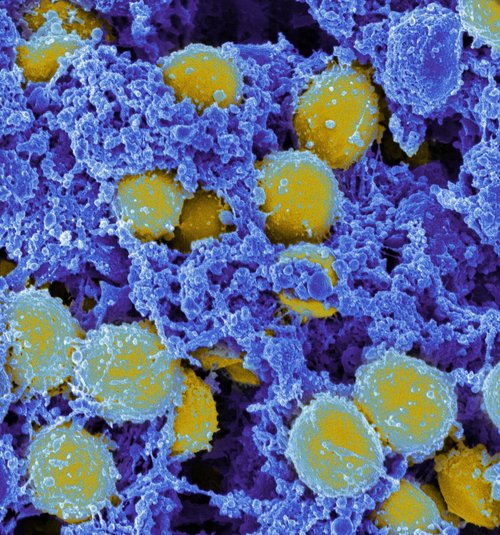 Staphylococcus aureus Bacteria