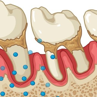 Periodontitis increases the risk of gastrointestinal dysfunction: an update on the plausible pathogenic molecular mechanisms