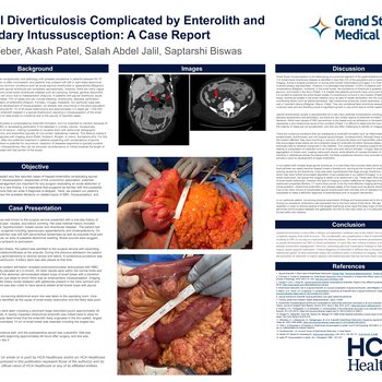 Jejunal Diverticulosis Complicated by Enterolith and Secondary Intussusception: A Case Report