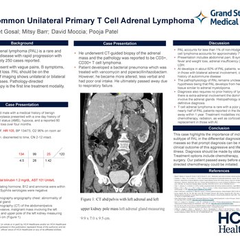 An Uncommon Unilateral Primary T Cell Adrenal Lymphoma