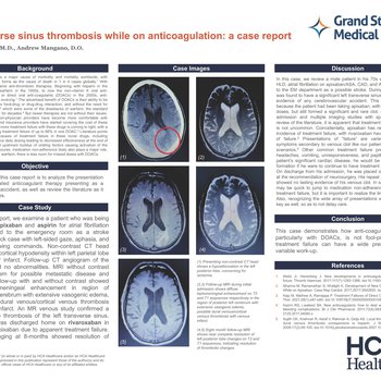 Transverse Sinus Thrombosis While on Anticoagulation: A Case Report