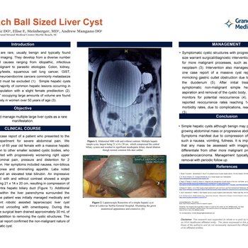 A Beach Ball Sized Liver Cyst