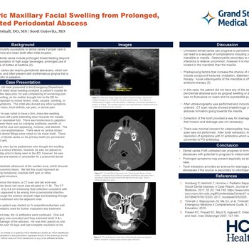 Pediatric Maxillary Facial Swelling from Prolonged, Untreated Periodontal Abscess
