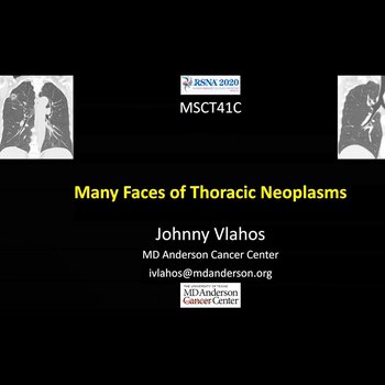 Many Faces of Thoracic Neoplasms