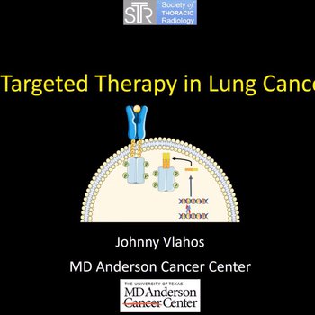 Targeted Therapy in Lung Cancer